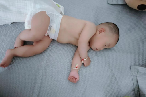 黄石六个月宝宝眼睛散光